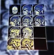 Clinical Implications: Sleep Disorders