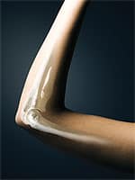 SVitamin K2—Essential for Healthy Arteries and Bones