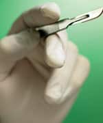 What You Need to Know: Cancer Surgery