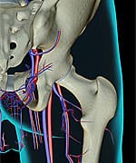 Vitamin K2 Reduces Prostate Cancer Risk