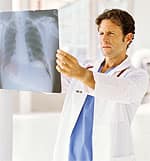 Sex Hormone-Binding Globulin