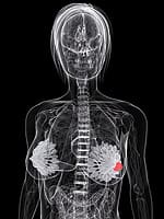 Nutrients to Quell NF-kB’s Inflammatory, Pro-Cancer Effects