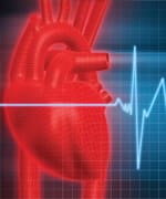 Cardiovascular Disease