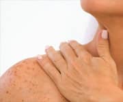 Melanin, Age-Related Skin Discoloration, And Pigment-Fading Compounds