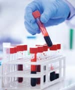 Thyroid Hormone Blood Testing