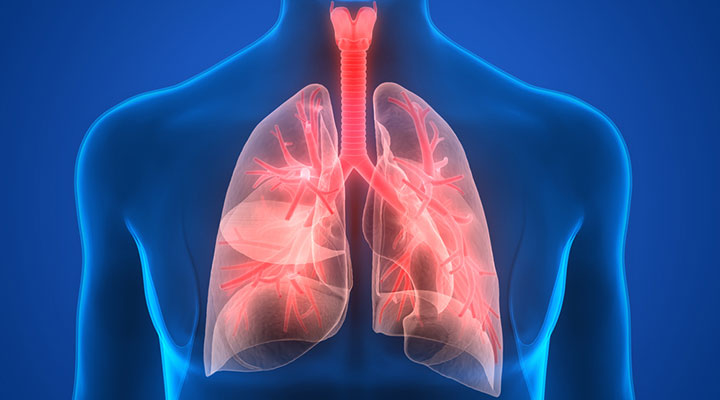 Pneumonia Overview | Life Extension