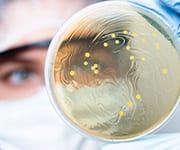 There are differences between prebiotics and postbiotics