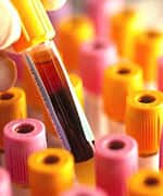 Test tube with blood