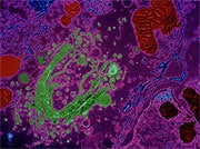 A Serendipitous Finding