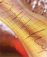 Heart Institute at New York Presbyterian/Columbia Medical Center