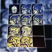 The Point of Prevention