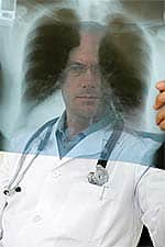 Vitamin E Decreases Lung Cancer Risk