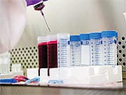 B Vitamins Beneficial in Celiac Disease