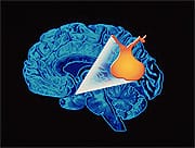 Is Synthetic GH Replacement Therapy Beneficial?