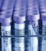 Excess Vitamin A Can Thwart Vitamin D