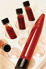 What are Optimal Free Testosterone Levels?