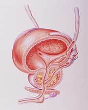 So You Have Low T—What Can Be Done About It?