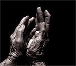 Optimal Arthritis Control