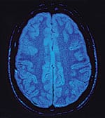 Imaging Clarity for Better Treatment