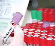 Supporting Immune Health in Cancer Patients