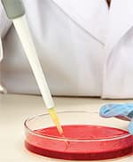 Modified Citrus Pectin Protects Kidneys