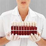 Greater Levels of Some Antioxidants Associated with Lower Risk of Metabolic Syndrome