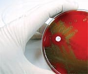 Branched Chain Amino Acids and Calorie Restriction