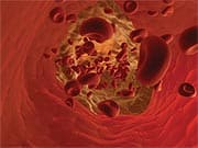 Do What It Takes to Maintain Optimal Blood Pressure 24-Hours a Day