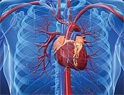 What Causes Aortic Calcification?