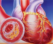 Pycnogenol® for Heart and Artery Health