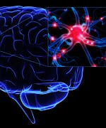 Novel Magnesium Compound Halts Neurologic Decay