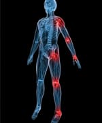 Targeting Osteoarthritis in Humans