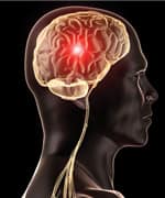 DHA Helps Preserve Brain Volume