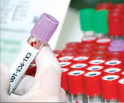 Sharply Discounted Blood Tests