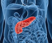 High Antioxidant Diet Could Lower Pancreatic Cancer Risk