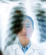 Quercetin Lowers Cholesterol, Fights Atherosclerosis