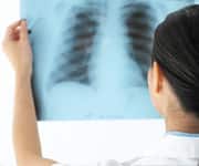 Quercetin Boosts Immunity, Fights Infection