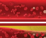 Healthy arterial blood flow