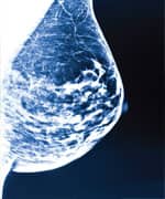 The Real Cause of Breast Cancer