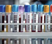 EPA Improves Insulin Sensitivity and Lowers Blood Glucose Levels in Overweight Diabetics