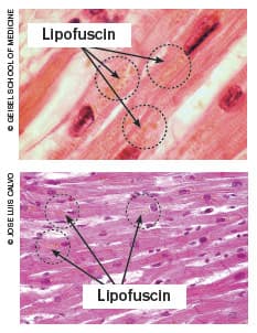 Lipofuscin Accumulation: Aging You Can’t See
