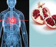 How To Slow And Reverse Atherosclerosis