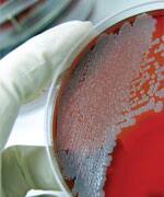 Probiotics And Chronic Disease