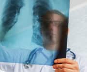 Low Bone Mineral Density Linked To Heart Failure