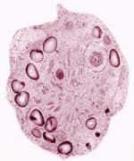 Novel Compounds Combat Skin Aging