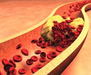 What Is Matrix Gla-Protein?