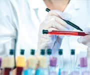 How DHEA Is Measured In The Blood