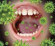 Systemic Disease Can Emanate in the Mouth