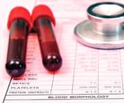 The Synergistic Combination of Astaxanthin and Omega-3s