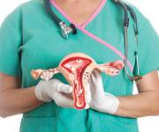 Metformin Lowers Mortality Risk in Diabetic Women with Cervical Cancer